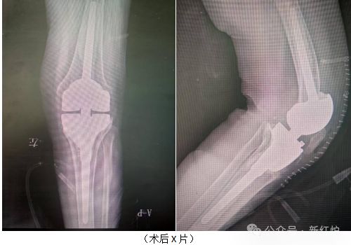 16日起雅康高速启用交通监控技术设备朝闻甘孜(图18)
